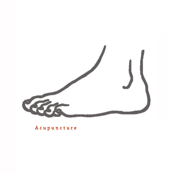 Acupuncture